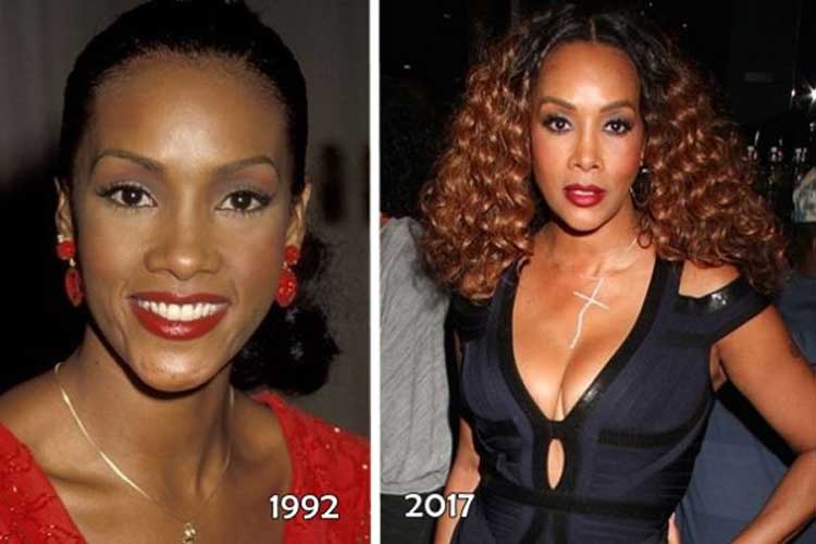 vivica a fox before and after plastic surgery