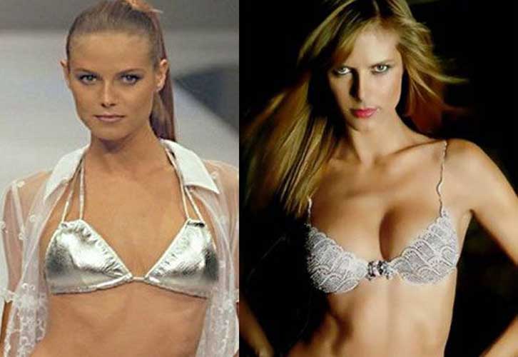 Heidi Klum Plastic Surgery