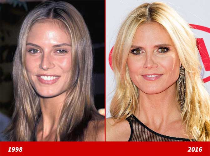 Heidi Klum Plastic Surgery