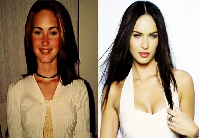 Megan Fox before and after plastic surgery boob job and ...