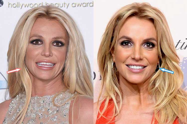 Britney Spears plastic surgeries