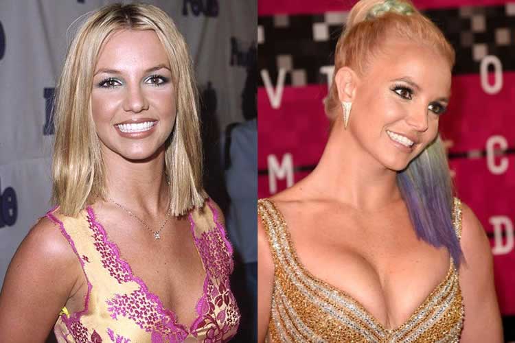 Britney Spears plastic surgeries