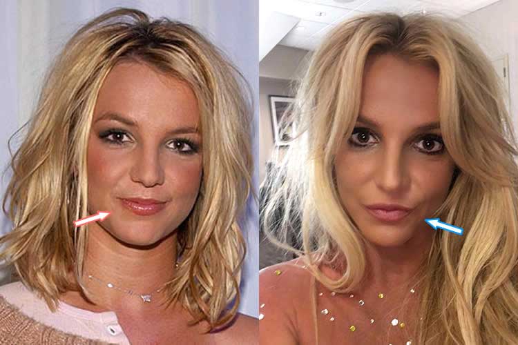 Britney Spears plastic surgeries(Britney Spears nose job ...