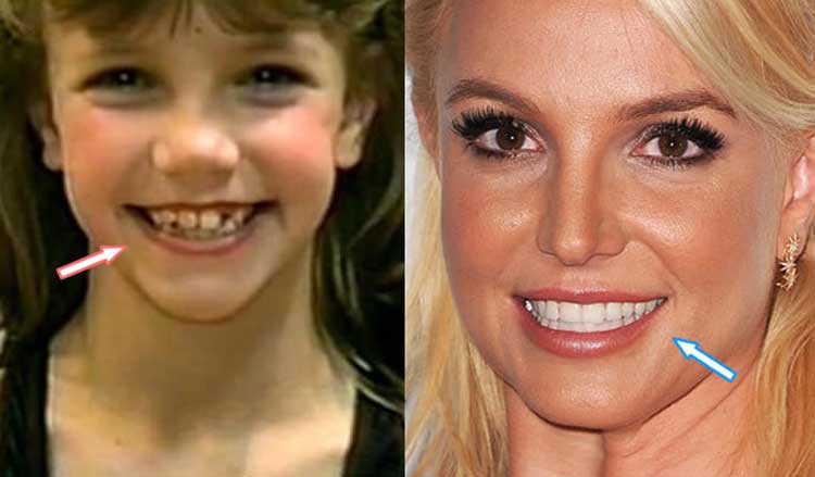 Britney Spears plastic surgeries(Britney Spears nose job ...