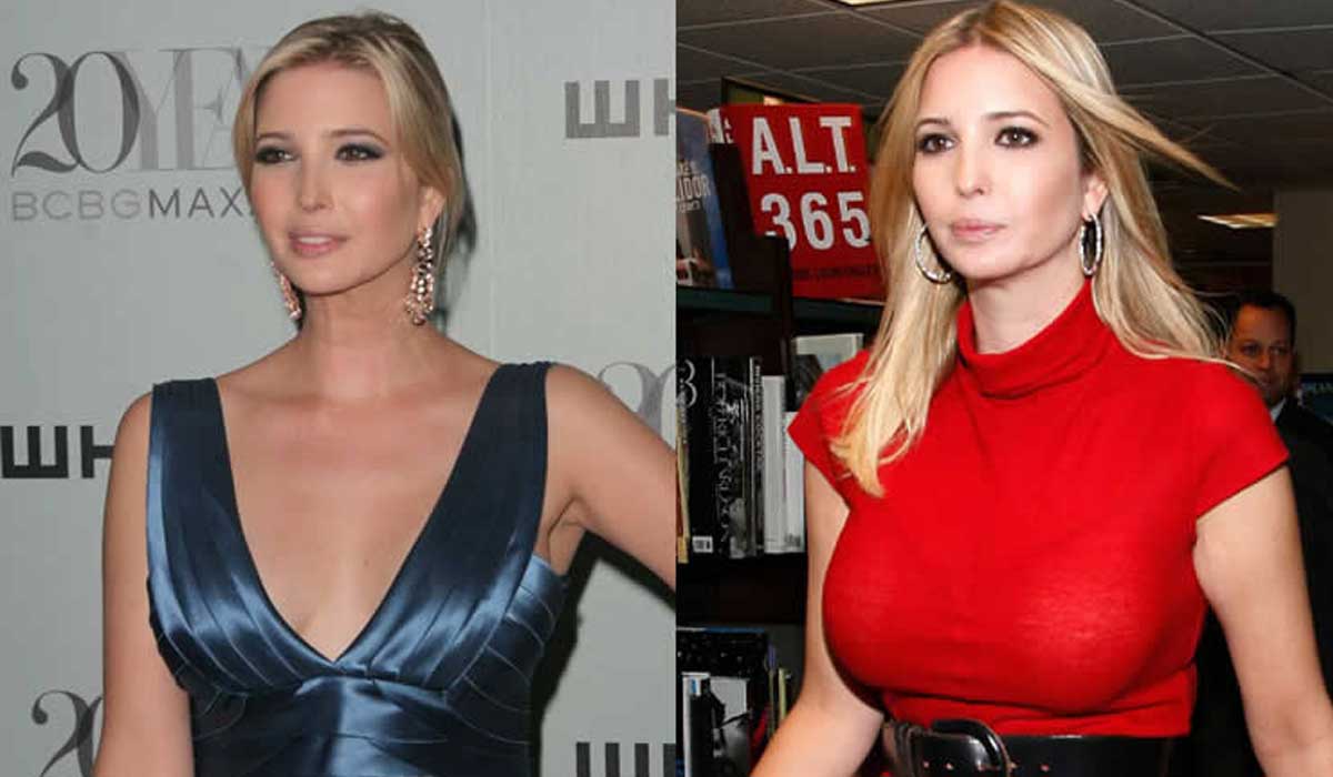 Ivanka Trump boob job