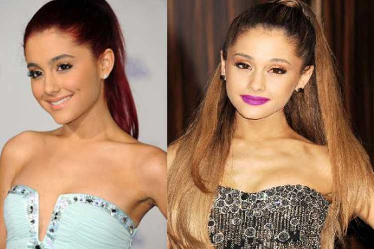 Celebrity Plastic Surgery Ariana Grande Plastic Surgery