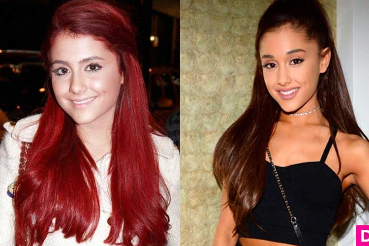 Celebrity Plastic Surgery Ariana Grande Plastic Surgery