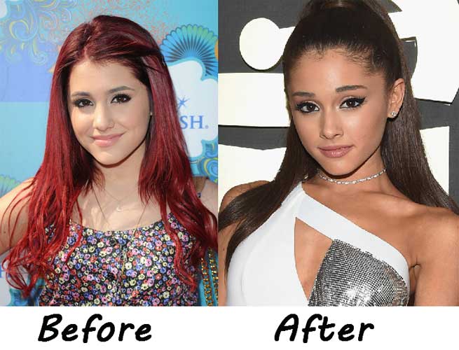 Ariana Grande Plastic Surgery face modification,lose