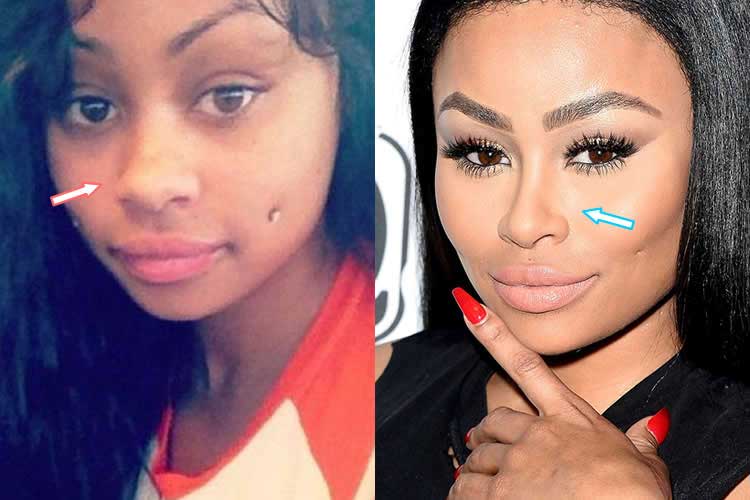 Blac Chyna Plastic Surgery