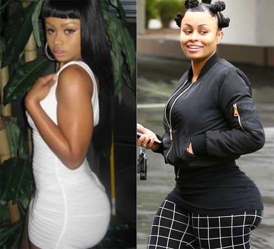 Blac Chyna Plastic Surgery