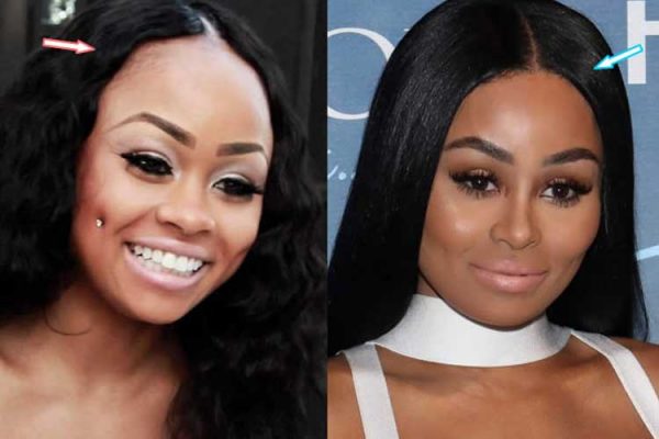 Blac Chyna Plastic Surgery: Nose Job,Boob Job,Bum Implants