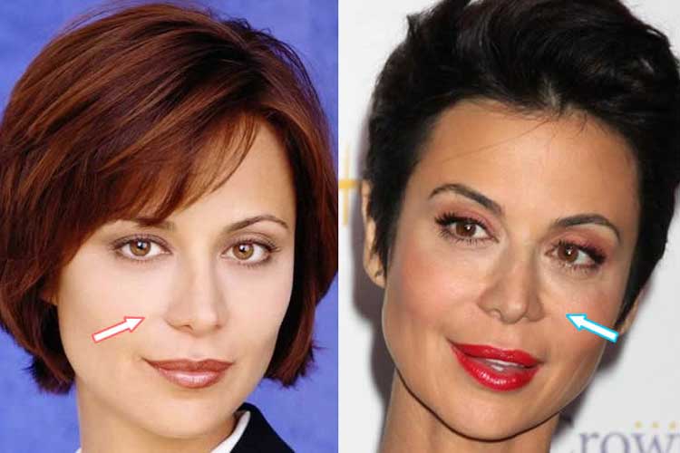 Catherine Bell Plastic Surgery: Boob Job, Neck Scar, Botox