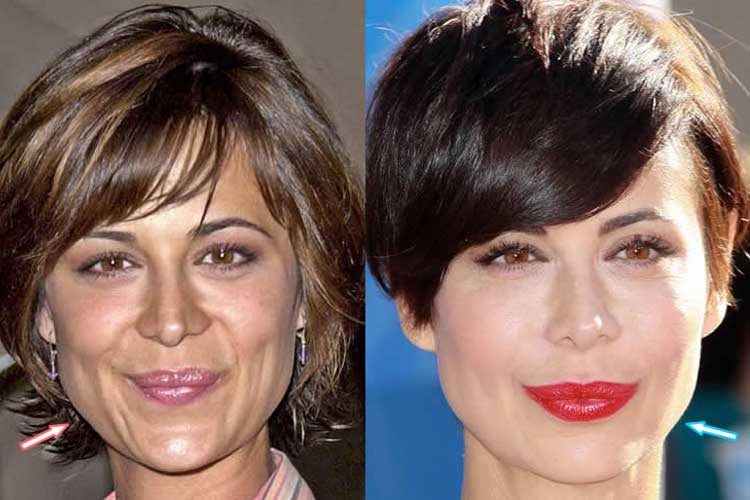 Catherine Bell Plastic Surgery