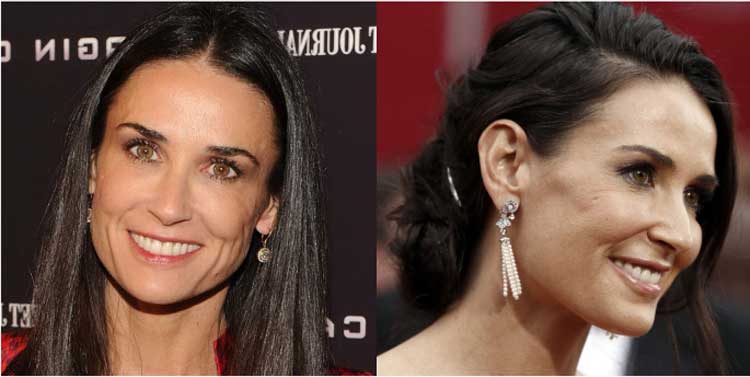 Demi-Moore-Plastic-surgery-before