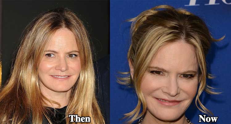 Jennifer Jason Leigh Plastic Surgery