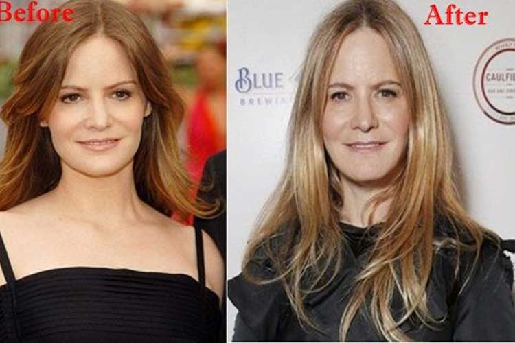 Jennifer Jason Leigh Plastic Surgery