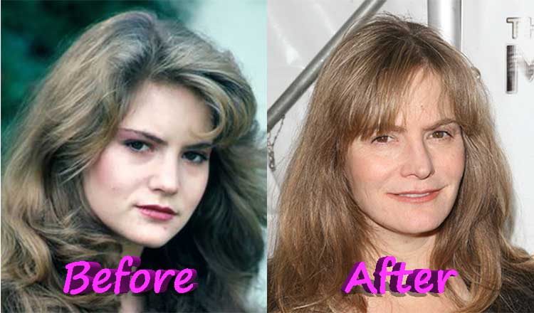 Jennifer Jason Leigh Plastic Surgery