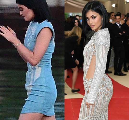 Kylie Jenner Before And After Nose Job Lip Injections Breast 