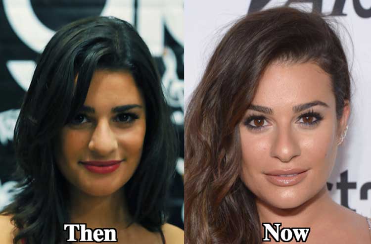 Lea Michele Plastic Surgery.