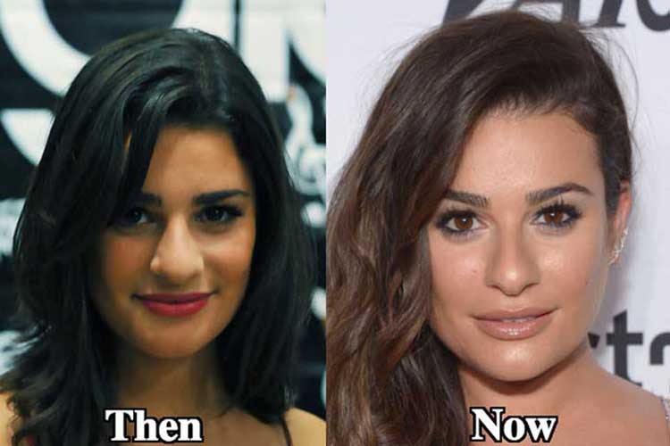 Lea-Michele-nose-job