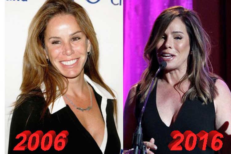 Melissa Rivers Plastic Surgery