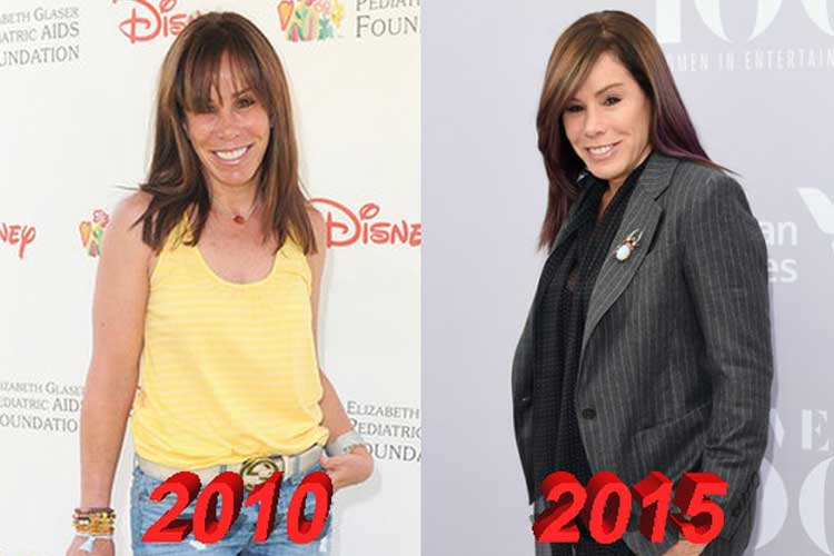 Melissa Rivers Plastic Surgery