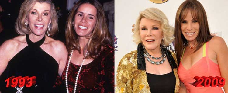 Melissa Rivers Plastic Surgery