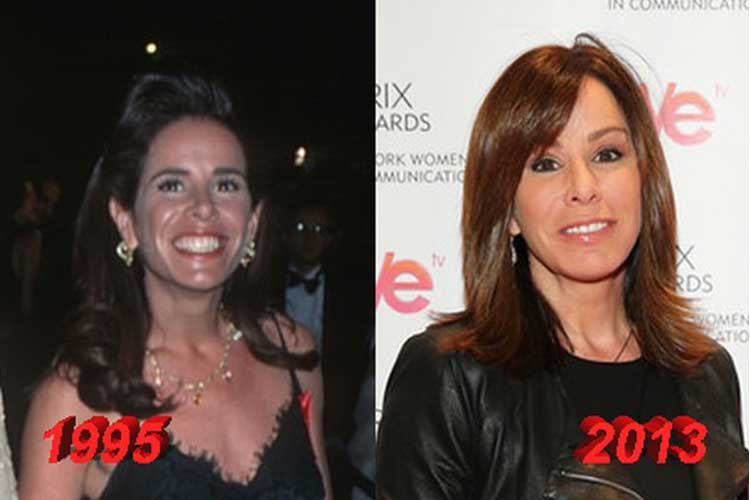 Melissa Rivers Plastic Surgery