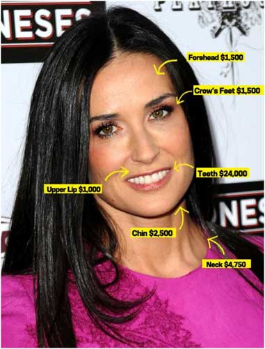 Demi Moore Plastic surgery: face,injectable filler,Botox