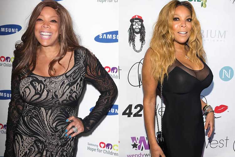 Wendy Williams Plastic Surgery