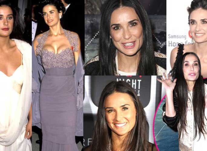 demi-moore-plastic-surgery-face