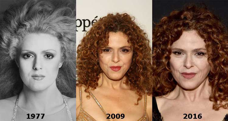 BERNADETTE PETERS PLASTIC SURGERY