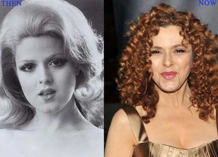 BERNADETTE PETERS PLASTIC SURGERY