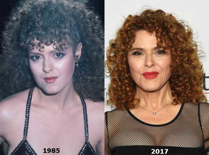 BERNADETTE PETERS PLASTIC SURGERY