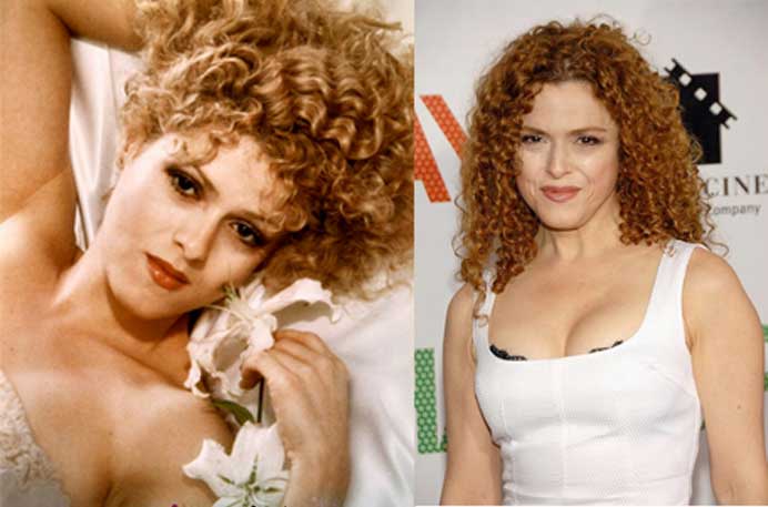 BERNADETTE PETERS PLASTIC SURGERY