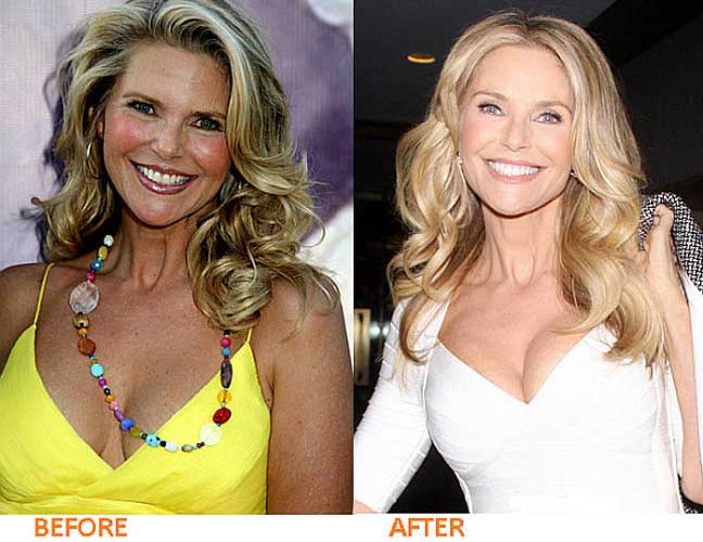 Christie Brinkley Plastic Surgery Many People Are Curious To Know The Answer