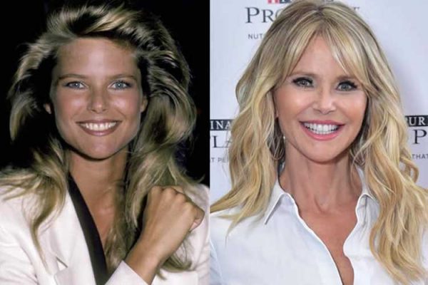 Christie Brinkley Plastic Surgery Breast Implants Botox Injections