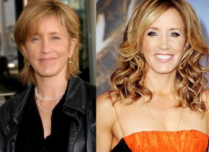 Felicity Huffman Plastic Surgery