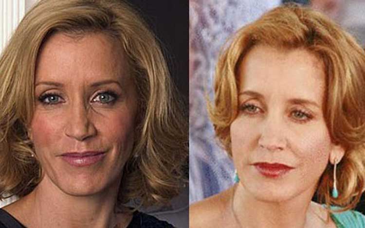 Felicity Huffman Plastic Surgery