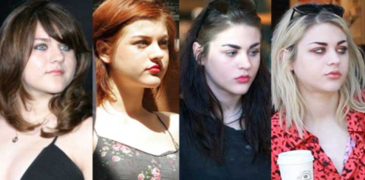 Frances bean cobain plastic surgery