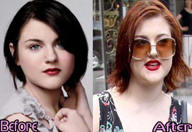 Frances Bean Cobain Plastic Surgery. 