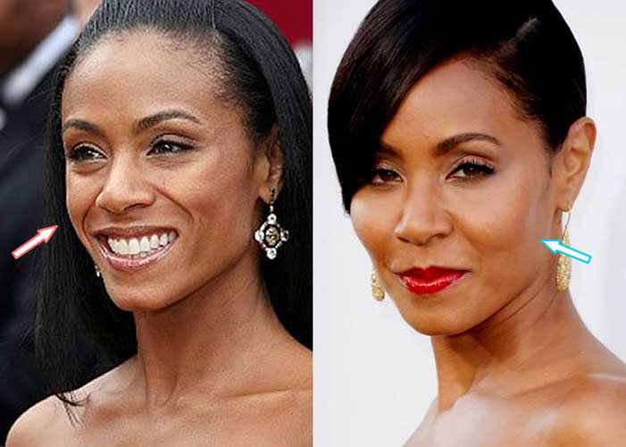 Jada Pinkett Smith Plastic Surgery Bad