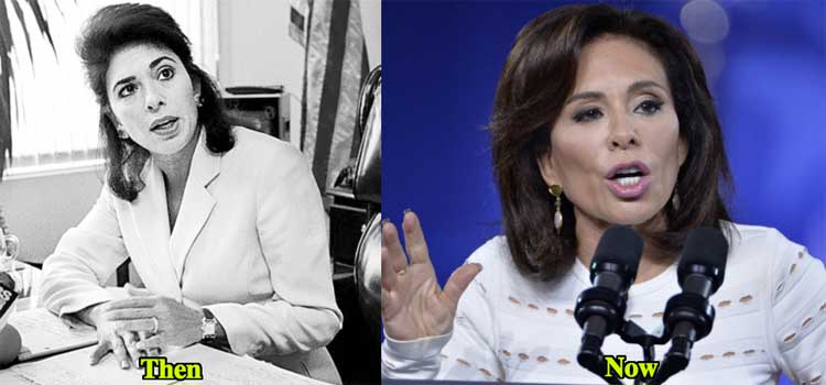 Jeanine Pirro plastic surgery