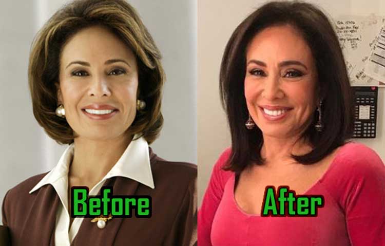 jeanine pirro plastic surgery