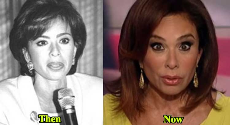 jeanine pirro plastic surgery