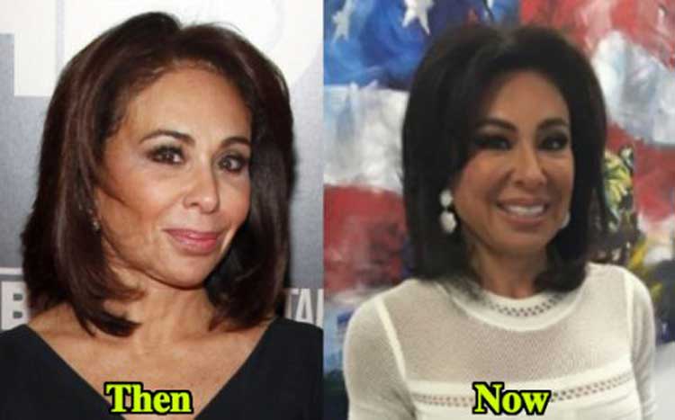 jeanine pirro plastic surgery