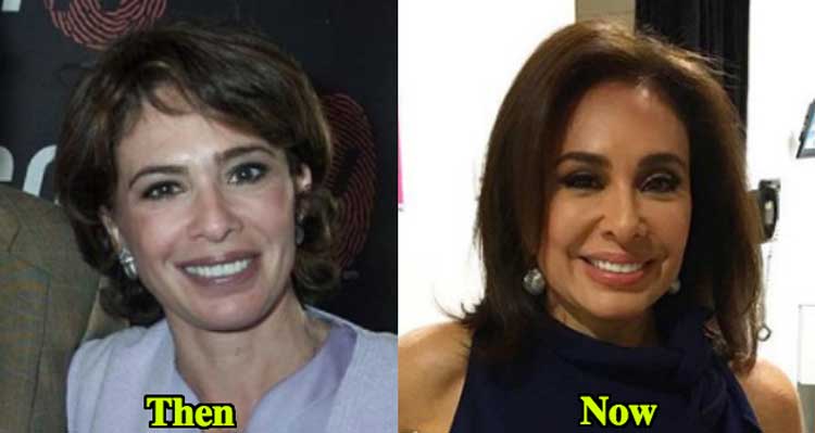 jeanine pirro plastic surgery