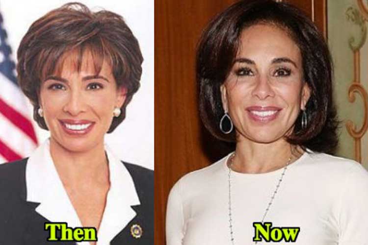 jeanine pirro plastic surgery