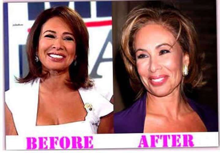 jeanine pirro plastic surgery