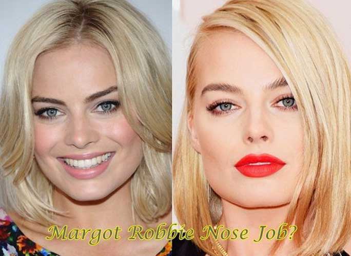 Margot Robbie Plastic Surgery